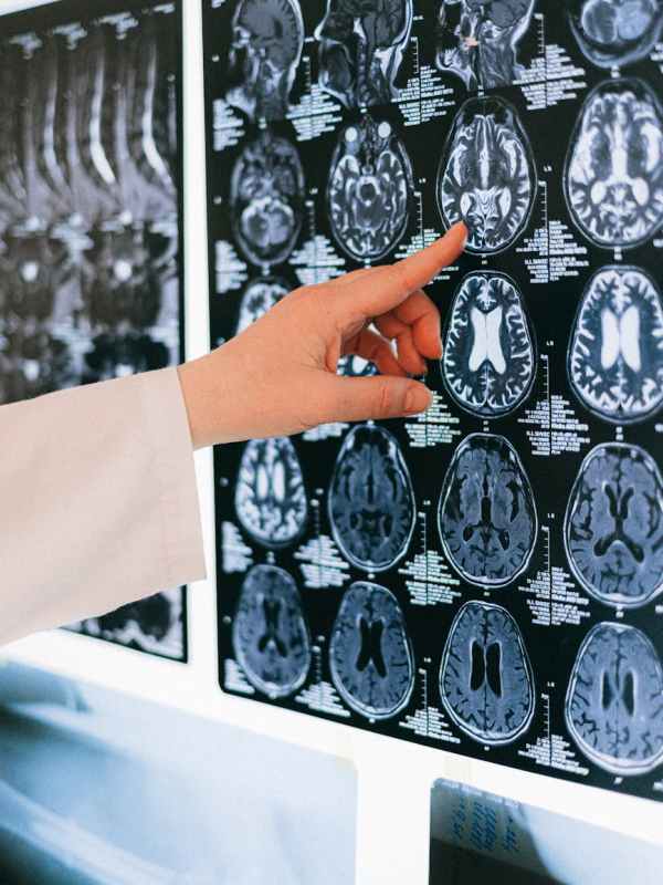 Bulletins d&rsquo;une neuroA – le&nbsp;diag